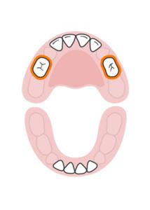 teeth-slideshow-teetheruption-5a